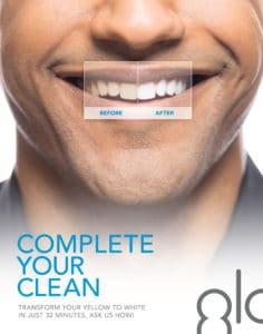 Cosmetic Dentistry Teeth Whitening