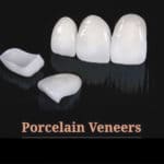 COSMETIC DENTIST PORCELAIN VENEERS Dental Implants Cosmetic LANAP Invisalign and Holistic Dentist!