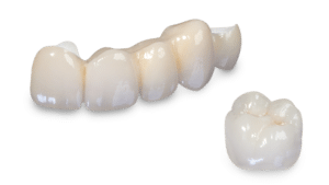 Dental Implants Cosmetic LANAP Invisalign and Holistic Dentist!